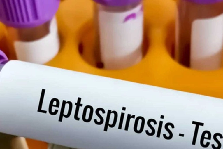 Aumentan los casos de leptospirosis: la provincia ya registra 15 contagios en lo que va del a&ntilde;o
